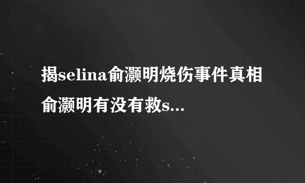 揭selina俞灏明烧伤事件真相 俞灏明有没有救selina