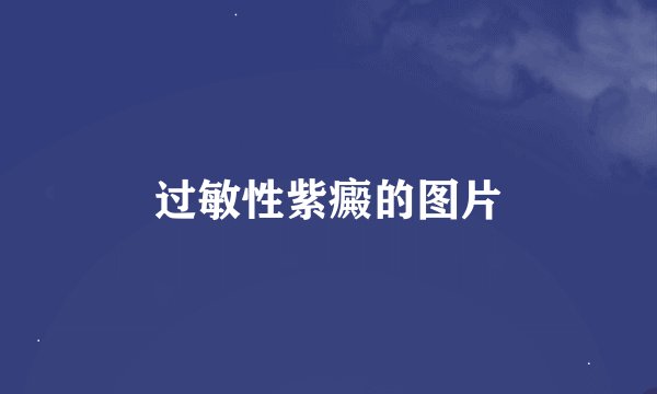 过敏性紫癜的图片