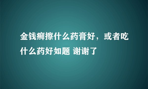 金钱癣擦什么药膏好，或者吃什么药好如题 谢谢了