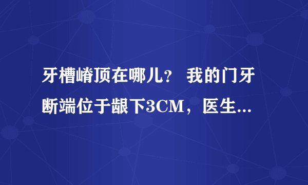 牙槽嵴顶在哪儿？ 我的门牙断端位于龈下3CM，医生帮我切除了部分牙龈，当天就做了纤维桩没有去牙槽骨。