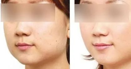 黑脸娃娃做几次好