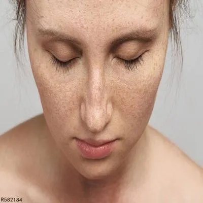 目前最有效的祛斑方法是什么