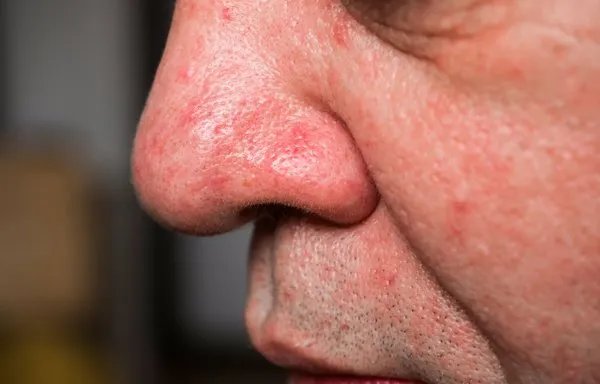 鼻滑的意思是什么服务