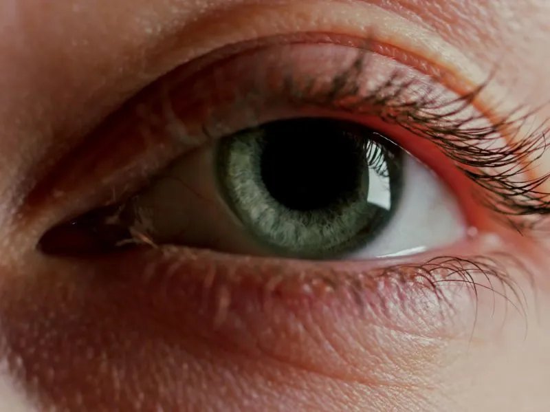 去眼角纹的方法