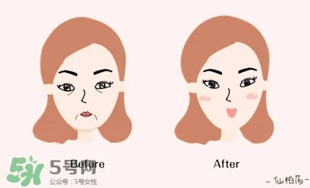 优弹素有激素吗?仙柏芮优弹素副作用