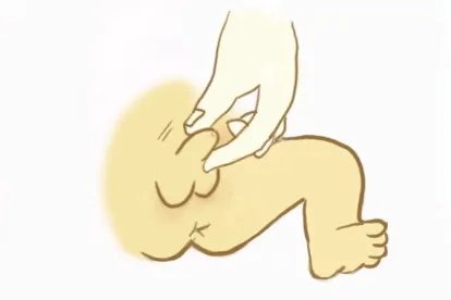 8个月宝宝小鸡的正常图片