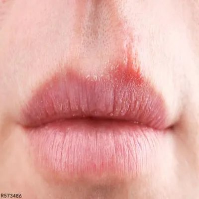 晚上口干口苦是什么原因引起的