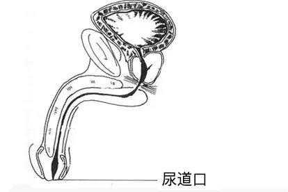 小男孩尿道口图片