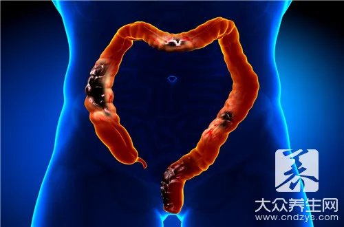  原位癌是什么意思