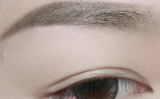 切眉手术的好处