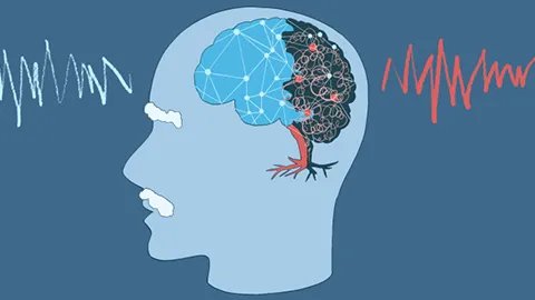 脑血栓偏瘫针灸有用吗