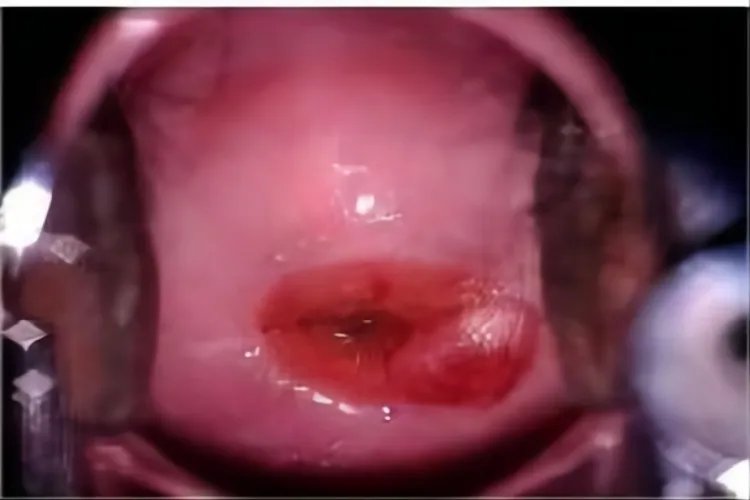 什么是纳囊的图片大全