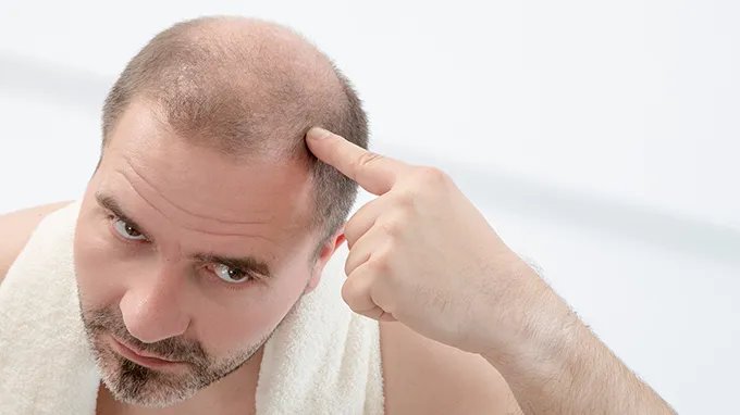 植发能保持多久