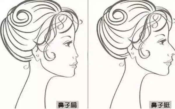 歪鼻子矫正大概多少钱