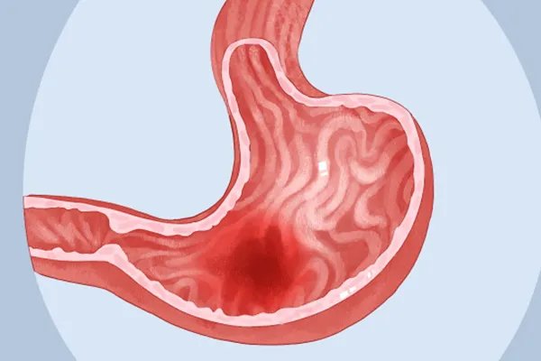 中药小草乌的功效与作用