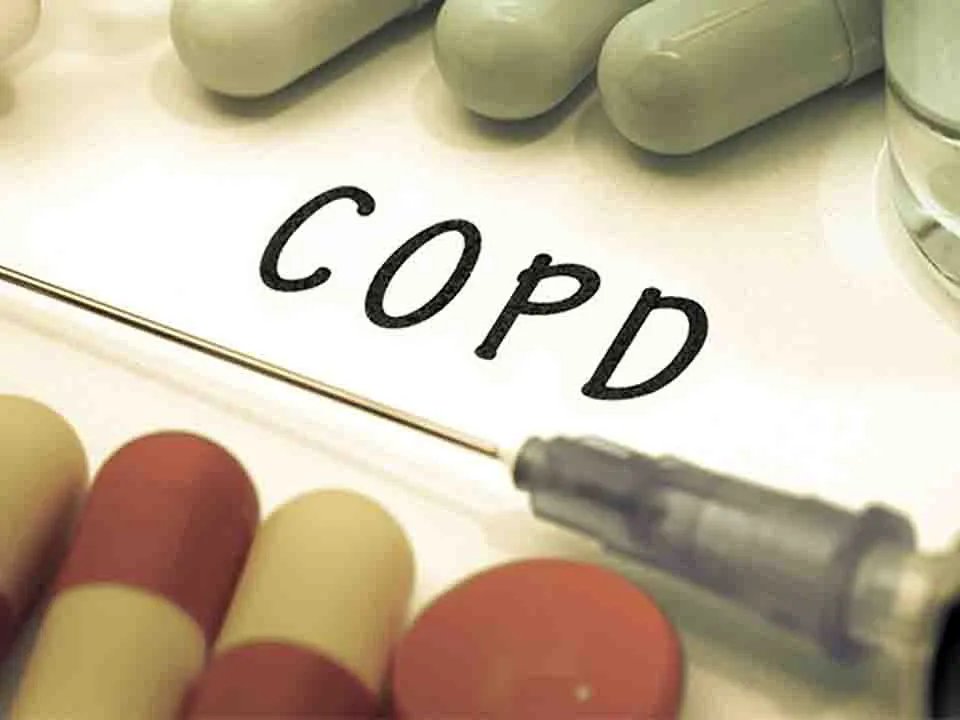 长痔疮该怎么办呢