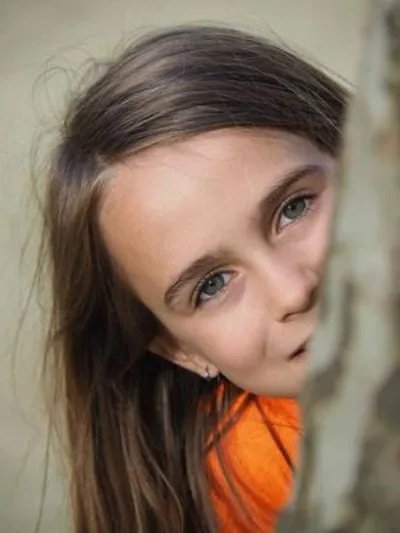 脸上黄褐斑的原因有哪些