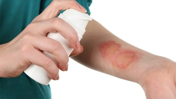 云南白药喷剂的作用