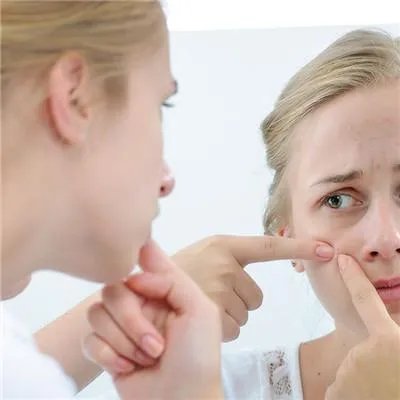 祛痘什么效果好