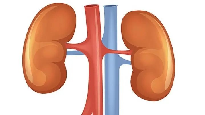 肾结石是如何形成的呢？