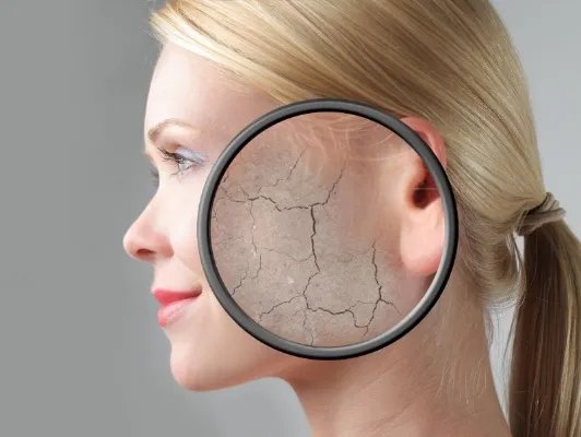 皮肤暗沉的原因