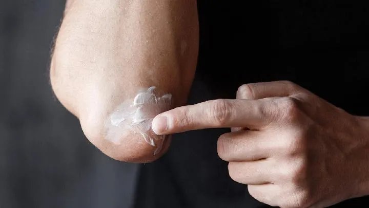 治疗白癜风的偏方都有哪些