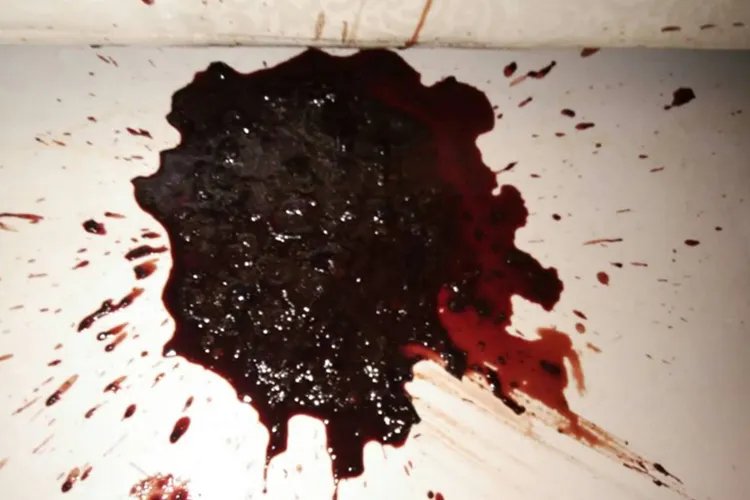 甲醛会导致身体出现哪些状况图片