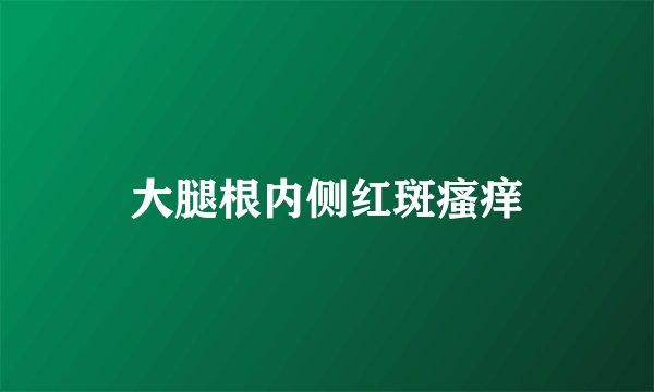 大腿根内侧红斑瘙痒