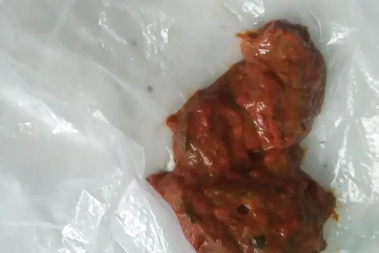 甲醛会导致身体出现哪些状况图片