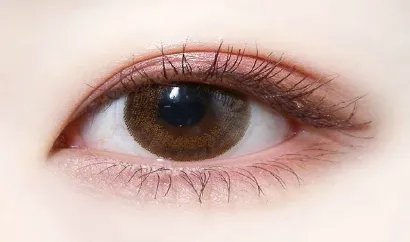 眼部埋线多少钱