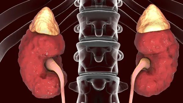 飞机打多了肾虚怎么调理 肾虚吃什么东西补得快