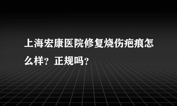 上海宏康医院修复烧伤疤痕怎么样？正规吗？
