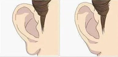 丰耳垂的效果怎么样