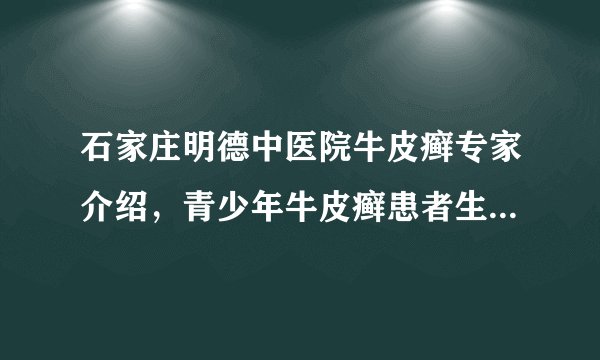 石家庄明德中医院牛皮癣专家介绍,青少年牛皮癣患者生活中要注意什么?