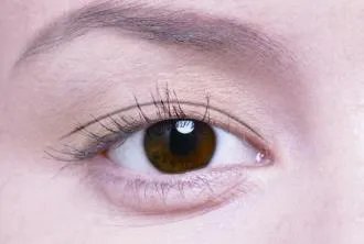 双眼皮修复前后需要注意什么