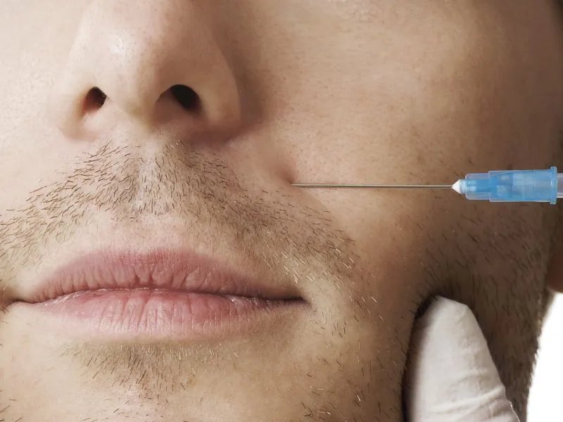 有红血丝应该怎么办