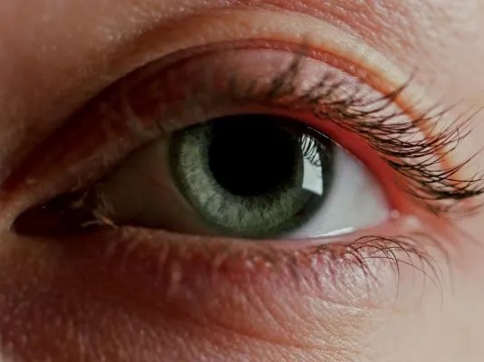 眼珠发黄怎么办