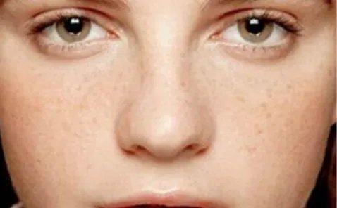 片仔癀去斑效果怎样