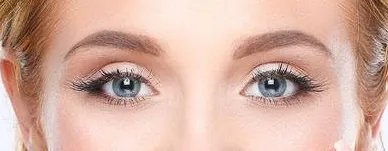 上睑下垂矫正注意