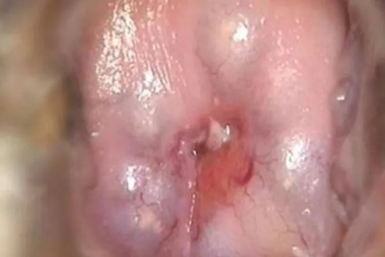 什么是纳囊的图片大全