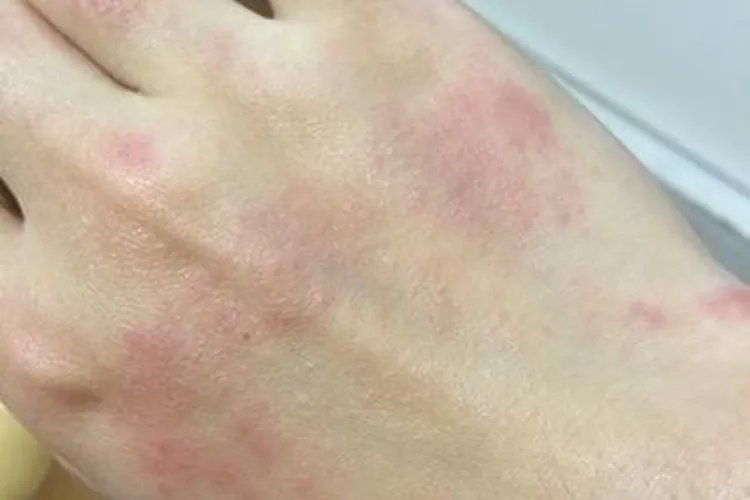 甲醛会导致身体出现哪些状况图片