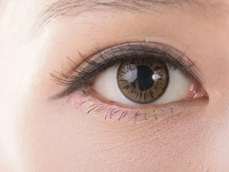 眼睛下有细纹要怎么办