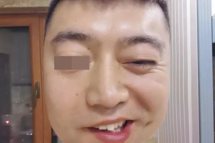 掉线风病症状图片