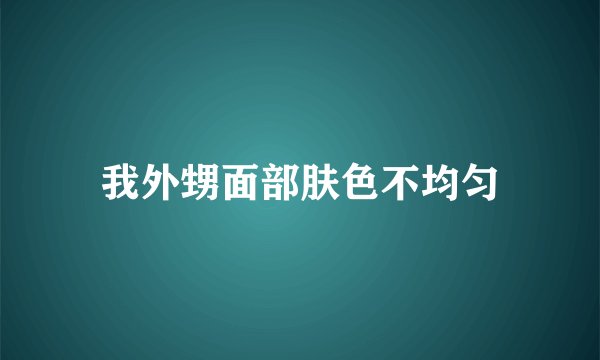 我外甥面部肤色不均匀