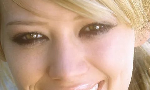 硅胶隆鼻的价格