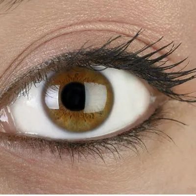 开眼角怎么开的