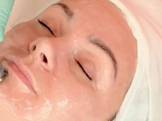 颜面部除皱的方法