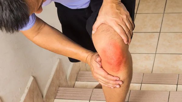 什么是膝关节人工关节置换术