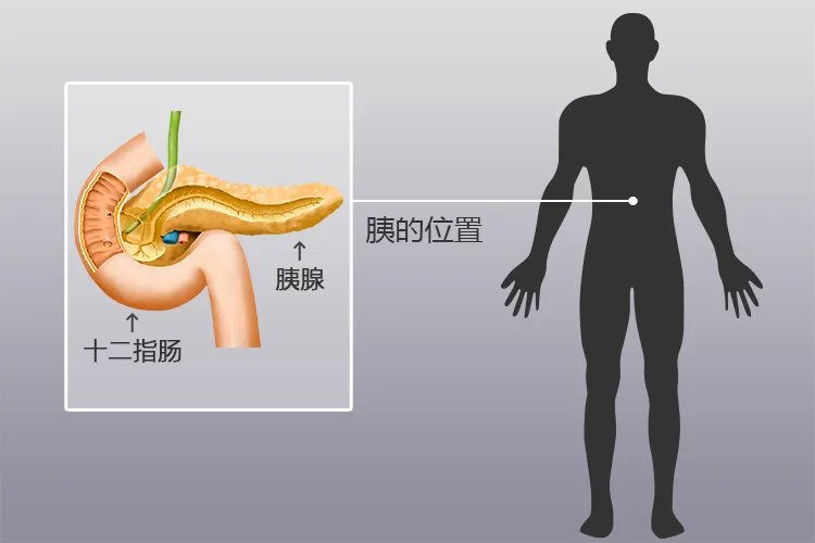 胰腺位置图