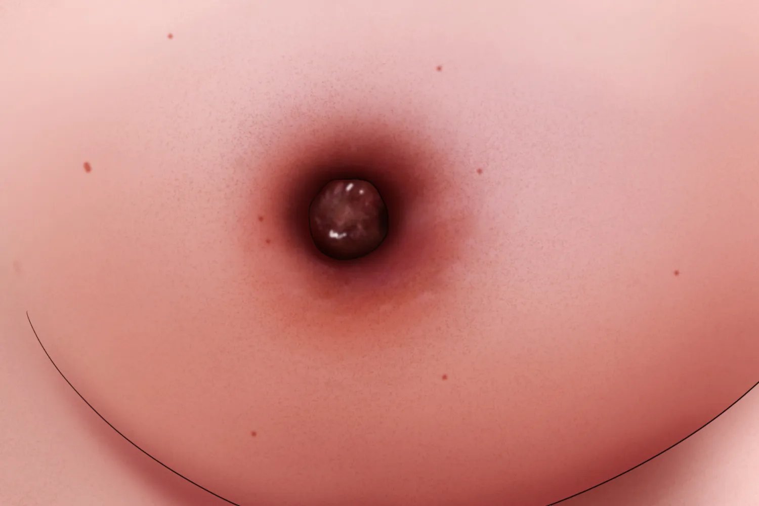 女性乳腺癌早期的图片大全